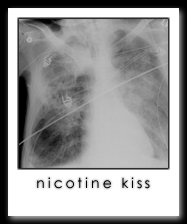 Nicotine Kiss
